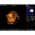 Kardiale tragbare Farbdoppler-Ultraschall-Maschinen-Preis-medizinische Sonar 2D 3D Echokardiographie Ecografo USD Echo-Maschine 4D